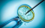 Beware! Using two embryos for IVF could cut the chance of having a baby by 25%