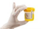 Urine samples can now be used to detect Parkinson's disease