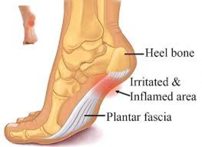 Does your Foot pains? Do follow these tips to get relief !