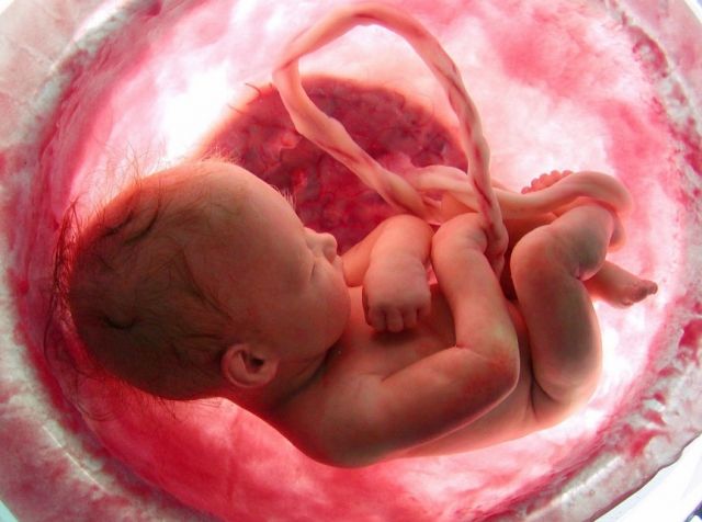 Heart Diseases Originate in the Womb!!!