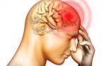 Different Types of Headaches You Should Know!!!