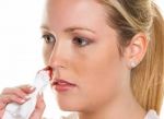 Natural remedies to stop “Nosebleed”