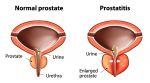 What are the benefits of Prostate Massage Therapy?