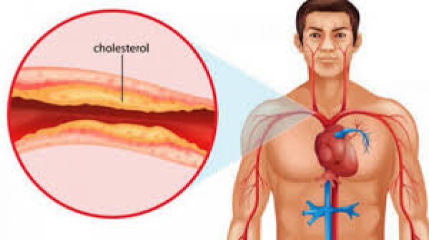 Does cholesterol in your food matter?