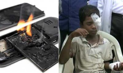 Telangana: 2 Children injured after the explosion of phone battery
