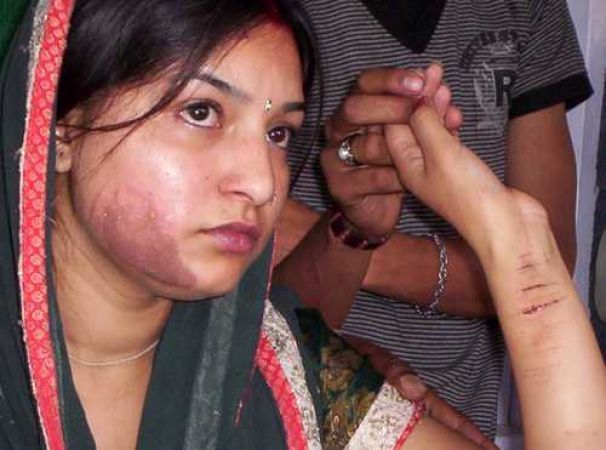 Man brutally beats wife, demands dowry from in-laws