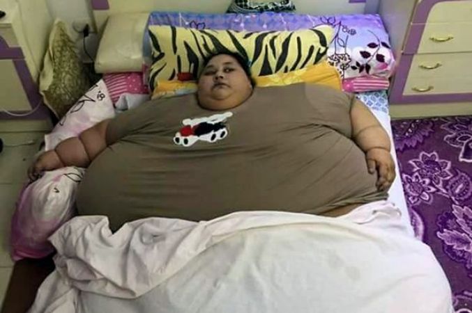 विश्व की सबसे मोटी महिला का हुआ इलाज