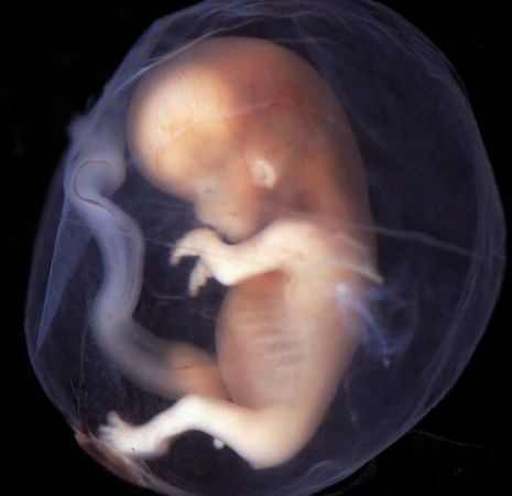 आखिर नाले के पास कैसे पहुंचे 19 कन्या भ्रूण, महिला की मौत से उठ रहे सवाल