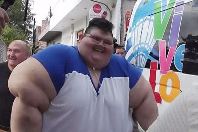 विश्व के सबसे मोटे व्यक्ति फ्रांको ने करवाई सर्जरी