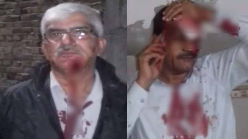दिल्ली: विजिलेंस टीम पर हुआ जानलेवा हमला, पुलिसवालों पर ही लगे आरोप