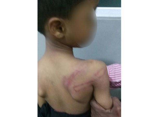 Hyderabad: Teacher detained for beating 5-year-old