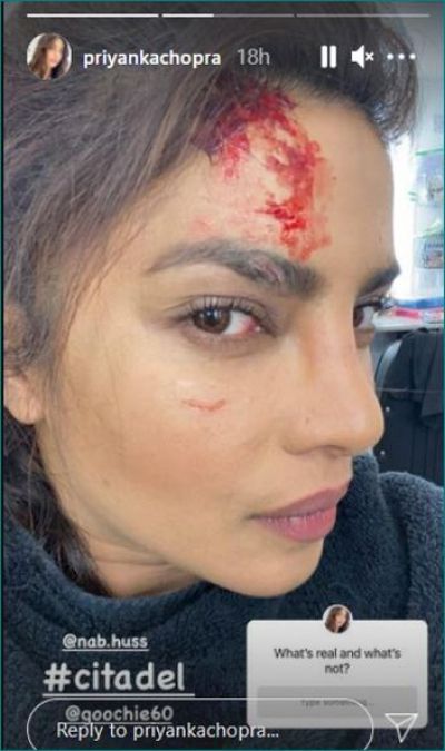 Priyanka Chopra got injured! showed both real and fake wounds