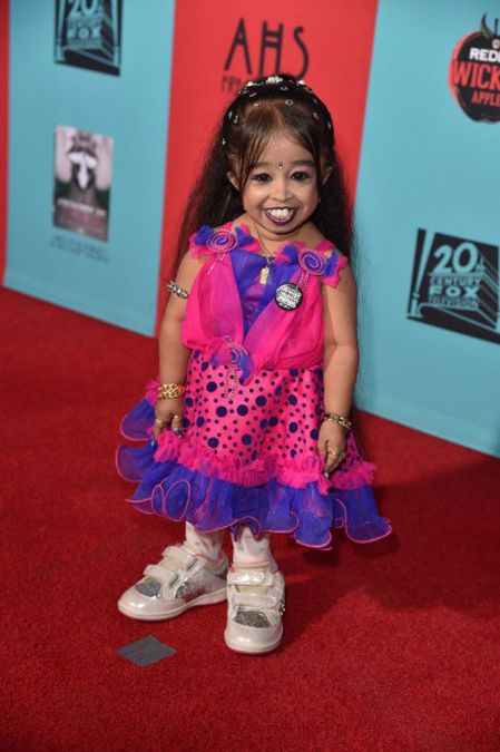 Why is Jyoti Amge so small? hold Guinness World Records