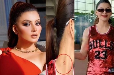 Urvashi's anger erupted over the matter of love bite, said this big thing