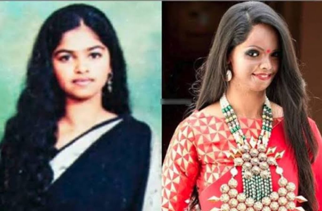 This Tiktok video of Acid Attack Survivor Laxmi Agarwal goes viral, watch video here