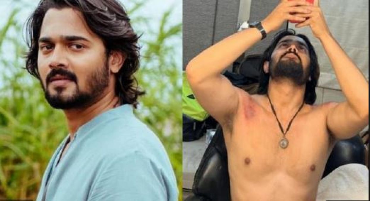 Bhuvan Bam injured in the accident