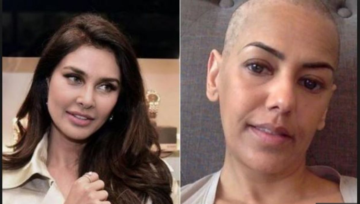 Cancer happened 6 months ago, now this actress revealed by sharing photo