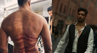 Vicky Kaushal devours whips for 'Sardar Udham,' fans shocked to see bruises