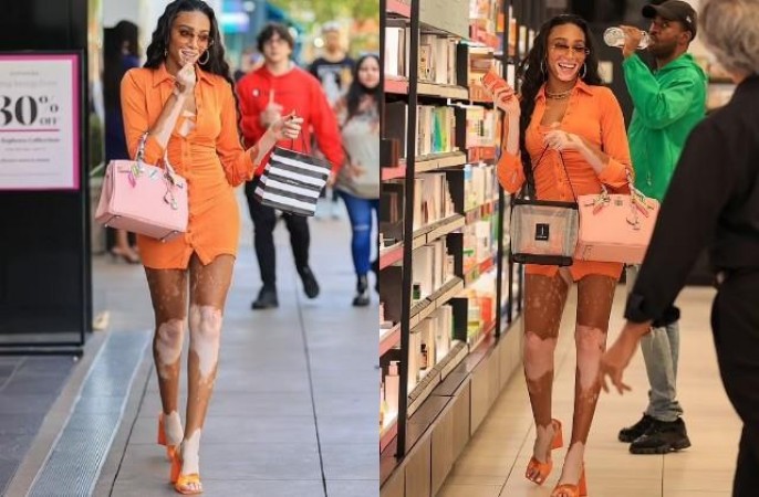 Why Winnie Harlow is so famous even after having white spots on her body, actress explained