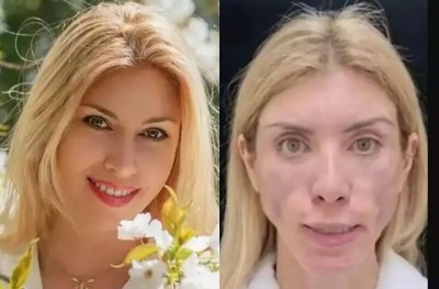In the process of looking beautiful, this actress got her face in a bad condition.