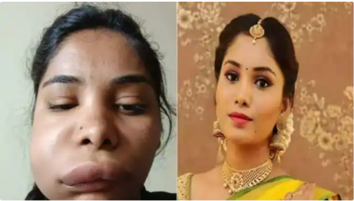 This actress's face was damaged due to canal therapy, the actress accused the doctor