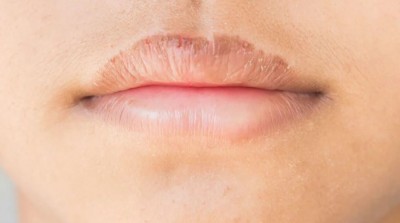 If the lips were not moisturized in the summer, do not get upset; you will get rid of this trick immediately.