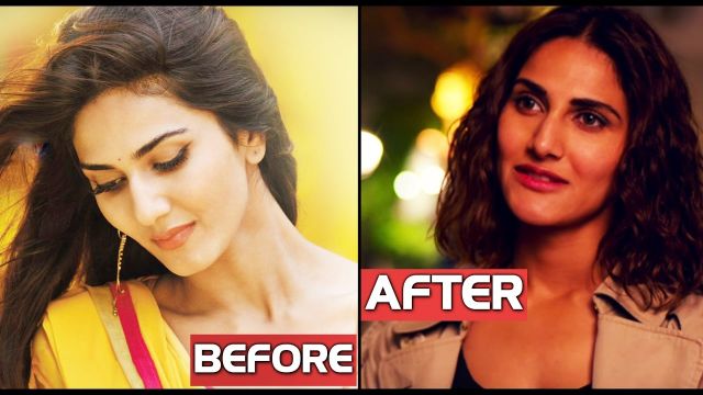 Vaani Kapoor : 'She can't afford to go under the knife'