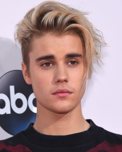Justin Bieber, who was a victim of serious illness, has paralysis on half of his face due to this