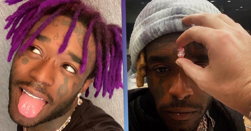 'Fans ripped $24 million pink diamond out of his forehead' says Rapper Lil Uzi Vert