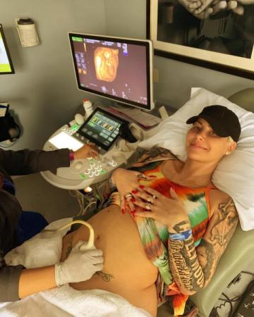 Amber Rose announces her pregnancy,read on
