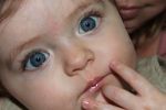 बच्चों की आँख कमजोर होने के लक्षण