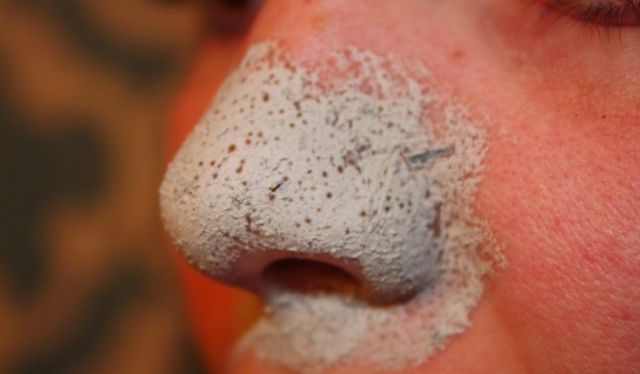 To get rid of stubborn blackheads, start this work from today