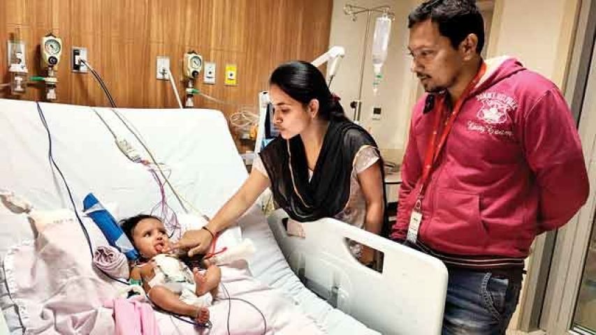 Successful heart surgery of 4 month baby who suffered 20 heart attacks