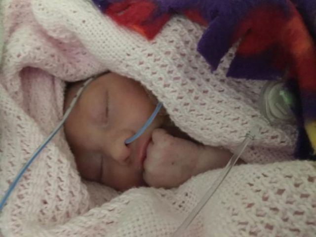 Baby girl survived after Doctors said she won't Live for Long!