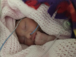 Baby girl survived after Doctors said she won't Live for Long!