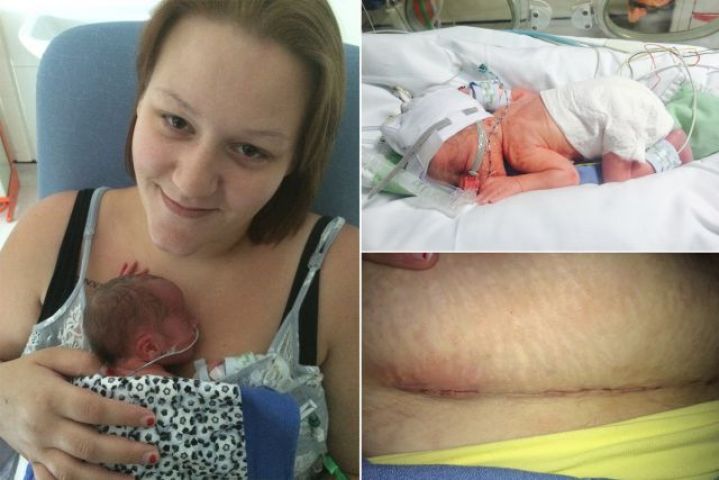 Doctors cut the stomach of woman after they couldn't find New Born Baby!