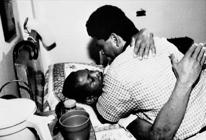 These pictures of people suffering from AIDS, will bring Tears in your Eyes!!!