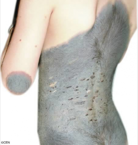 Weird birthmarks on human body ever !