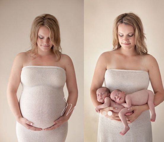 Before and after pictures of pregnancy, which you have never seen !