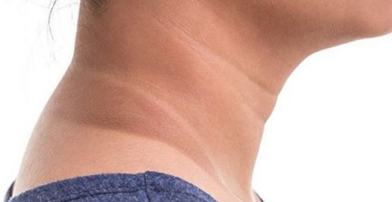 If you also tan neck, then these can be the reasons