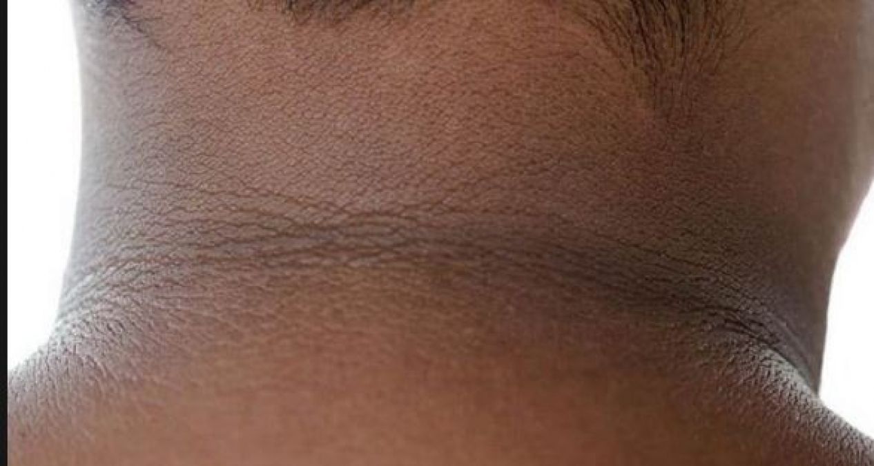 If you also tan neck, then these can be the reasons