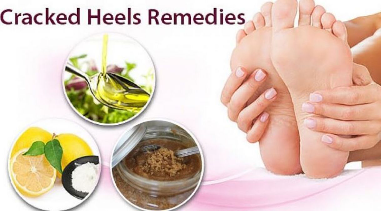 Amazing tips to get rid of cracked feet and make them beautiful