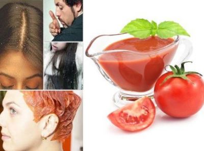 Don't let dandruff damage your image, use Tomato juice to fight dandruff
