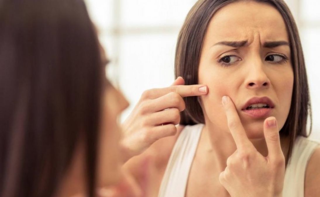 2 Natural Skin Solutions To Treat Pimples Quickly And Effectively