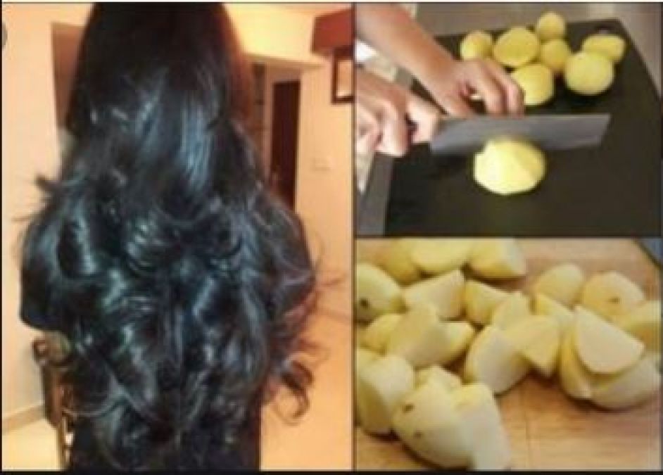 National Potato Day: Besides eating, Potato is also beneficial for hair, Learn Benefits