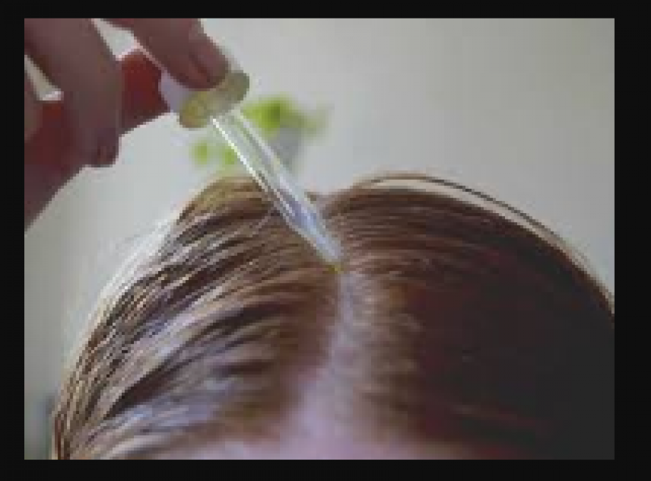 झड़ते बालो की समस्या में कॉड लिवर आयल के है अनेक फायदे , जाने