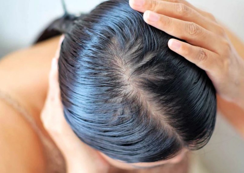 How to Keep Your Hair Clean in Winter Without Shampoo and Water