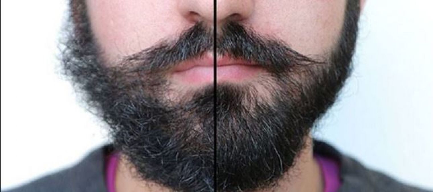 Dandruff in beard, so follow these tips