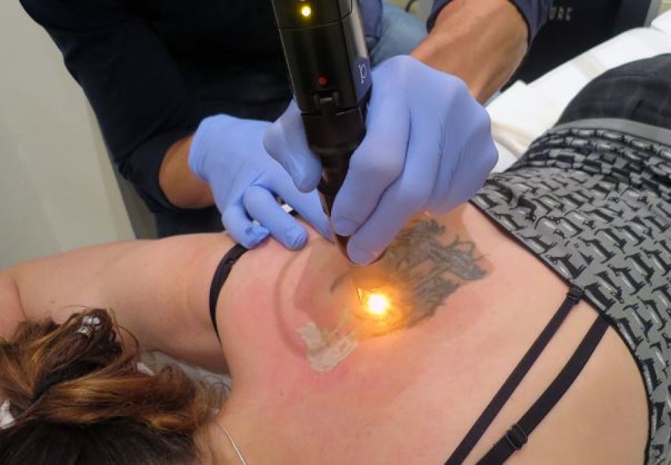 Follow these tips to take care of the skin after Tatoo removal!