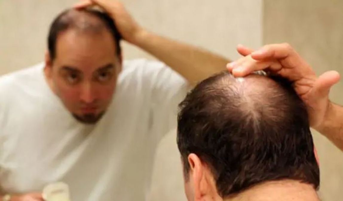 If you face Baldness at an early age, so first know the cause of this!